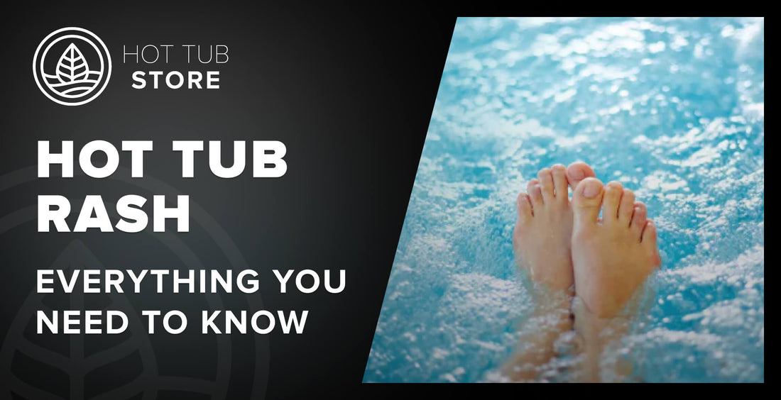 EVERYTHING YOU NEED TO KNOW ABOUT HOT TUB RASH